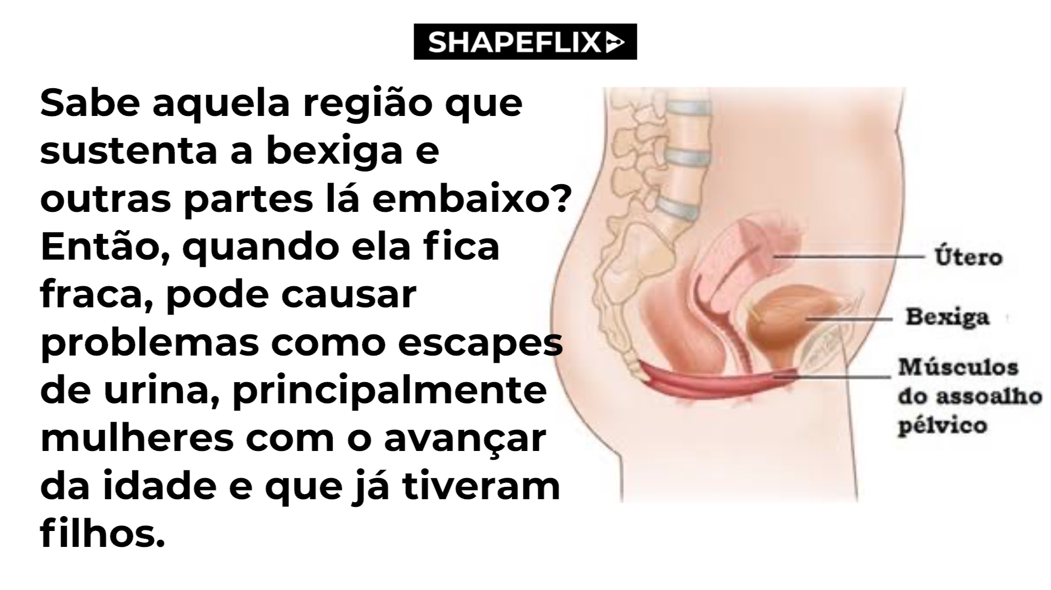 Dia 11 - slide 2